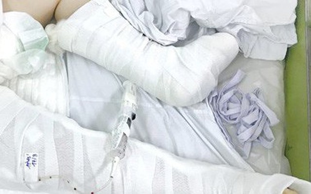 Rơi từ lầu 3, bé gái ở Sài Gòn thoát chết