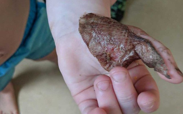 Con gái bị tổn thương nghiêm trọng vì một thứ người lớn chẳng thể ngờ, bà mẹ lên tiếng khẩn thiết cảnh báo các bậc phụ huynh