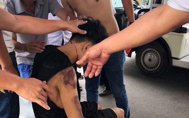 Xe điện mất lái tông vào nhóm du khách trong khu du lịch ở Đà Nẵng, 6 người bị thương
