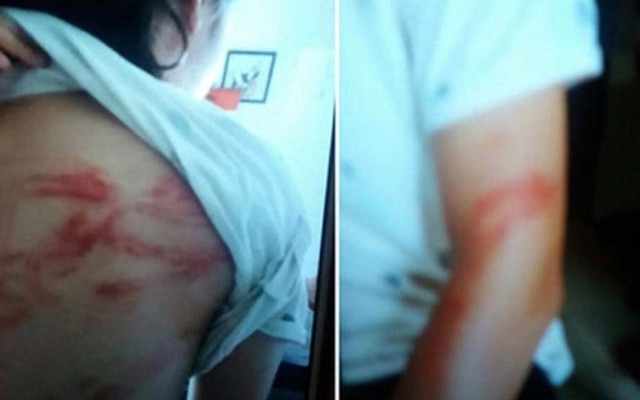 Hai cháu bé ở Hà Nội bị bố bạo hành đang ở nhà bác ruột