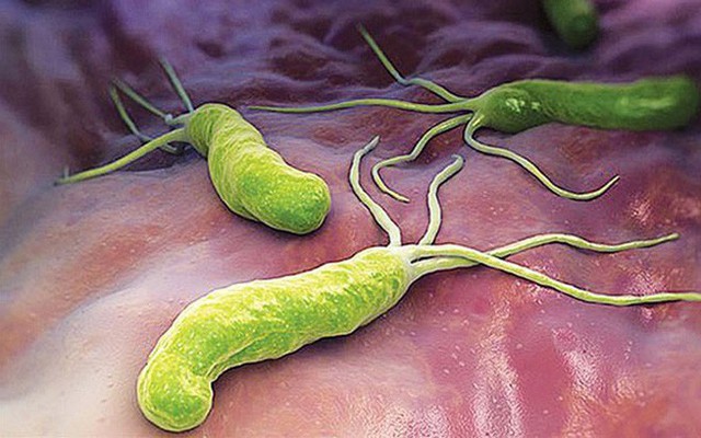 Nhiễm vi khuẩn Helicobacter Pylori (HP) có trở thành ung thư?