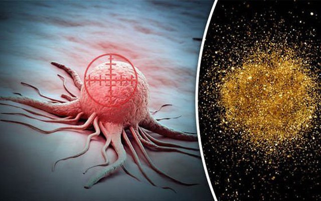 Nhắm mắt dùng nano vàng điều trị ung thư: Mất tiền, thiệt thân