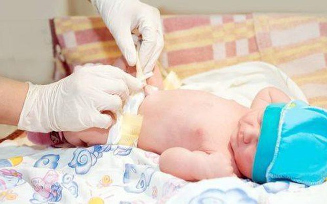 Từ vụ bé sơ sinh chết vì uốn ván: Cách ngừa uốn ván rốn sơ sinh