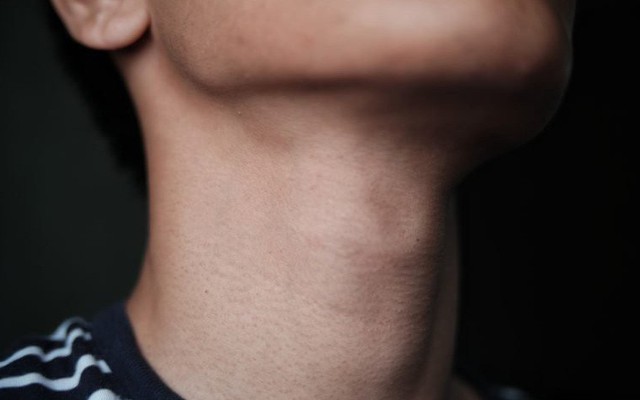 Xuất hiện 8 dấu hiệu này, đàn ông có thể mắc bệnh hiểm và khó chữa: Biết cũng chưa muộn!