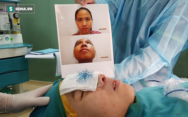 Hàng loạt cô gái "sống dở chết dở" vì biến chứng khi nâng mũi