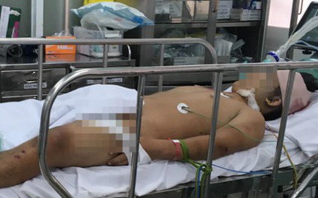 Bến Tre: Đi bão sau trận Việt Nam - Malaysia, chàng trai 17 tuổi đâm xe xuống sông nguy kịch