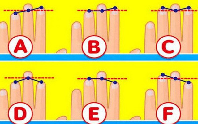 Tố chất bộc lộ qua độ dài 3 ngón tay trên bàn tay trái: Nếu ở dạng E, bạn rất thông minh, quyến rũ