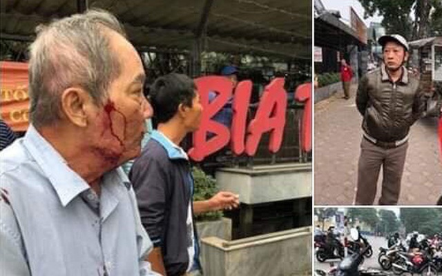 Hà Nội: Lái xe ôm đánh cụ ông U80 chảy máu mặt gây bức xúc dư luận