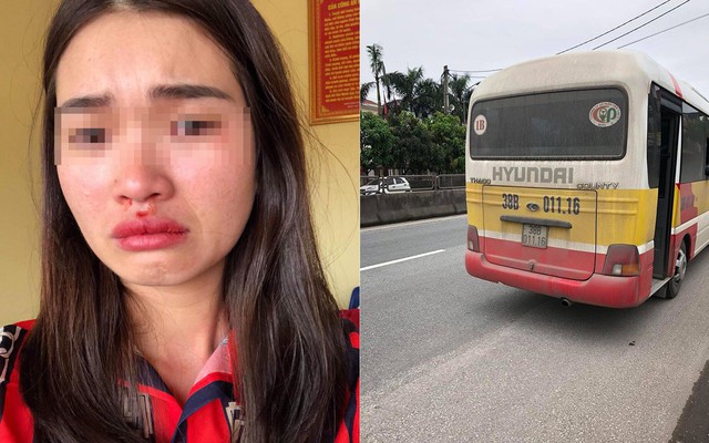 Vụ nữ khách bị đánh vì dám chụp ảnh xe buýt giả đánh võng: Công an đang làm việc với chủ xe