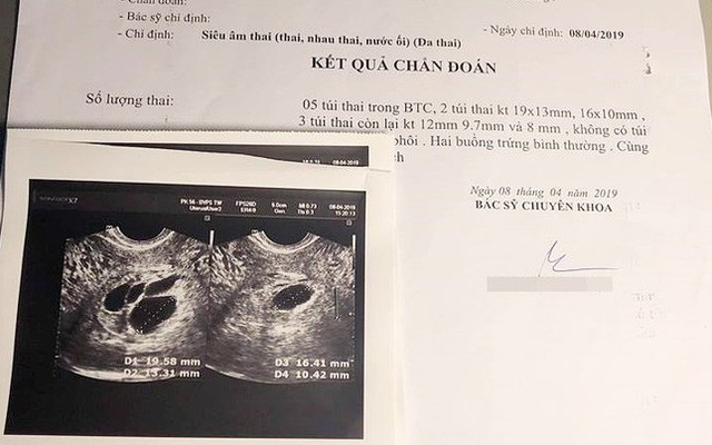 Bức thư chia tay nghẹn ngào người mẹ trẻ gửi đến 5 bào thai trong bụng, chưa kịp thành hình đã rời bỏ mẹ ra đi