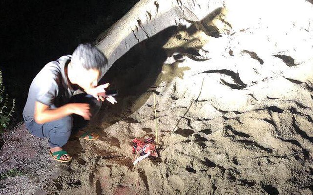 Bé trai bị đàn chó tấn công ở Hưng Yên đã tử vong