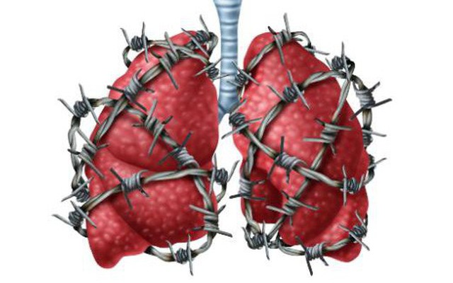 Người khỏe trước hết nhờ phổi: 6 việc giúp "giải phóng" phổi khỏi bệnh tật, ung thư