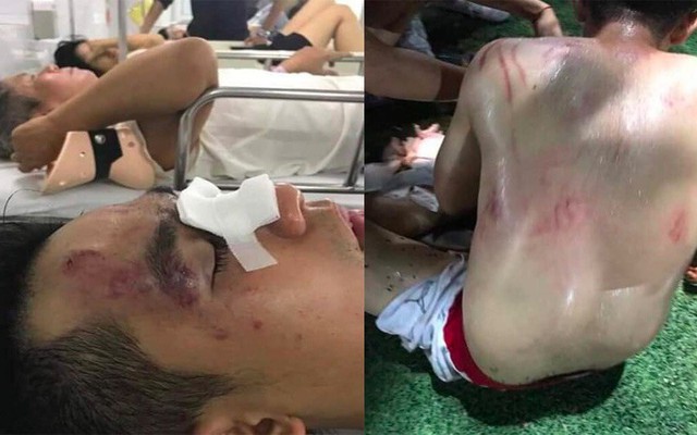 Bị đánh hội đồng trong lúc đá bóng, 1 "cầu thủ" nhập viện cấp cứu ở Hà Nội