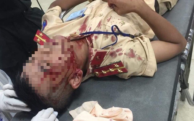 Đại uý CSGT đang làm nhiệm vụ bị người đàn ông cầm gạch đập trúng đầu nhập viện cấp cứu