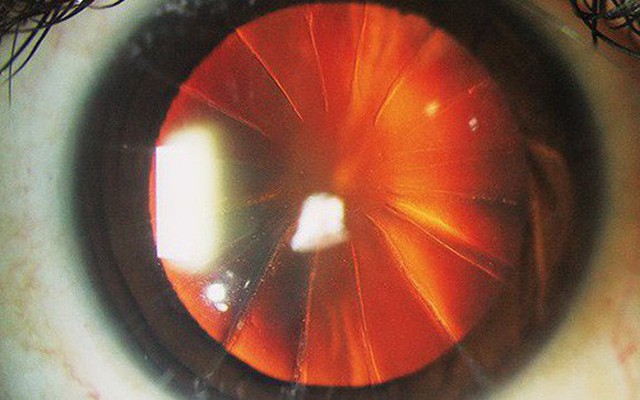Bệnh nhân với con mắt siêu hiếm trông như bánh pizza 8 miếng: Minh chứng cho thấy y học đã từng đáng sợ như thế nào