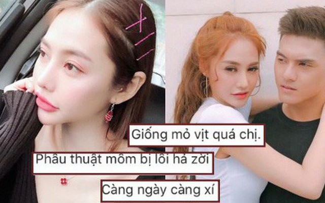 Linh Chi đáp trả khi bị chê phẫu thuật thẩm mỹ lỗi, miệng trông giống mỏ vịt