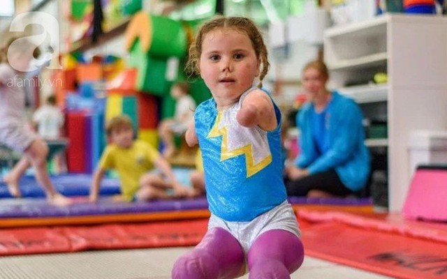 Bé gái 5 tuổi mất cả tứ chi vì viêm màng não tự tin tập môn thể thao mà ngay cả người đủ tay chân cũng e ngại