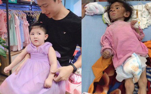 Hình ảnh em bé Lào Cai bụ bẫm đáng yêu trong bộ váy tím khi được bố nuôi bế khiến nhiều người chú ý