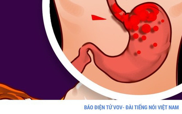 Bạn có biết: Nằm nghiêng phải là tư thế ngủ có thể gây hại sức khỏe?