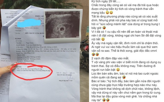 "Đặt vòng" vẫn phát hiện có con đúng 29 Tết, cô gái vội lao đến bệnh viện thì bác sĩ báo: "Kì tích đấy"