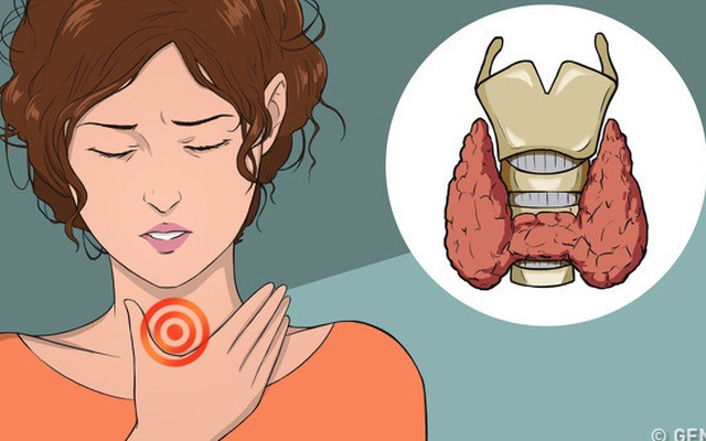 Bệnh cường giáp: Ăn thế nào để hỗ trợ điều trị và không làm cho bệnh nặng thêm?