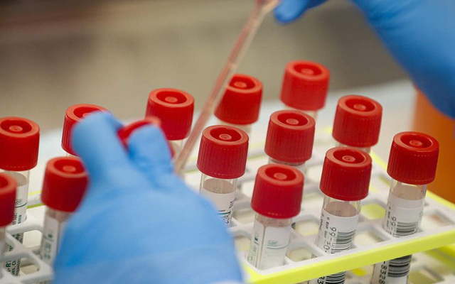 Mỹ thu hồi 12.000 bộ xét nghiệm SARS-CoV-2 do nhiễm khuẩn