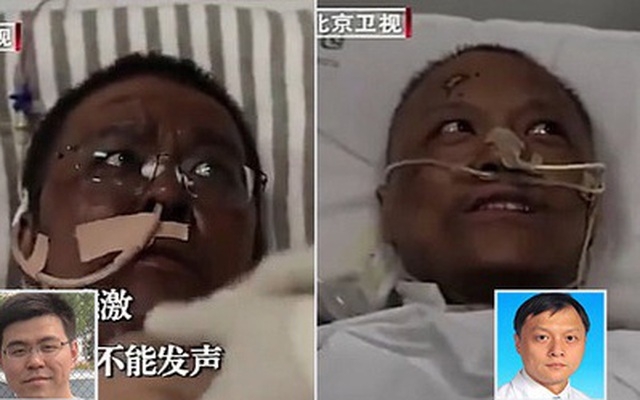 Hai bác sĩ Trung Quốc có làn da bị đổi sang màu nâu sau một thời gian dài chống chọi với Covid-19