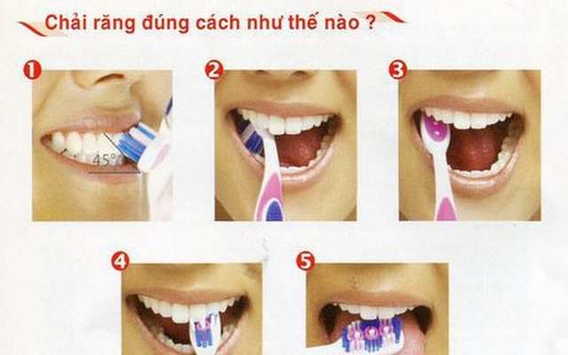 7 thói quen xấu thường gặp khi vệ sinh răng