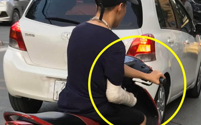 Xôn xao hình ảnh nam thanh niên bị gãy tay phải, vẫn liều mình vặn ga xe máy bằng... tay trái