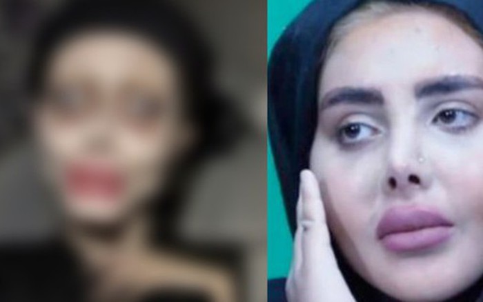 Mikro bikinili qizlar bilan jinsiy aloqa