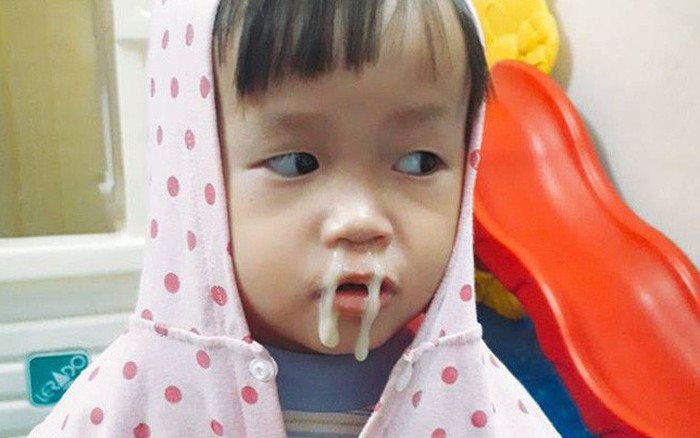 HIỆN TƯỢNG THÒ LÒ MŨI XANH Ở TRẺ KHÔNG NHẤT THIẾT PHẢI DÙNG KHÁNG SINH